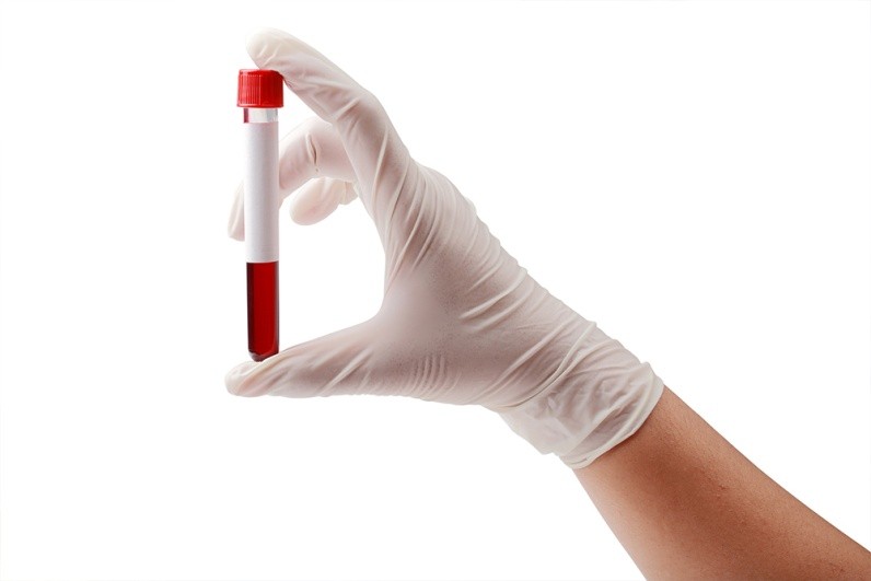 Общие правила подготовки к анализу крови